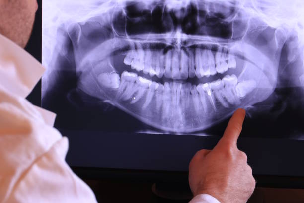 Best Emergency Treatment for Jaw Pain or Injury in New Richmond, OH