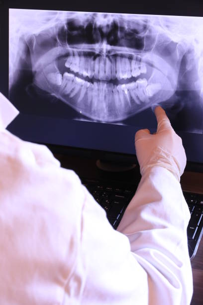 Best Emergency Wisdom Tooth Extraction in New Richmond, OH